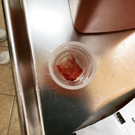 Red tissue sample in a clear plastic container.