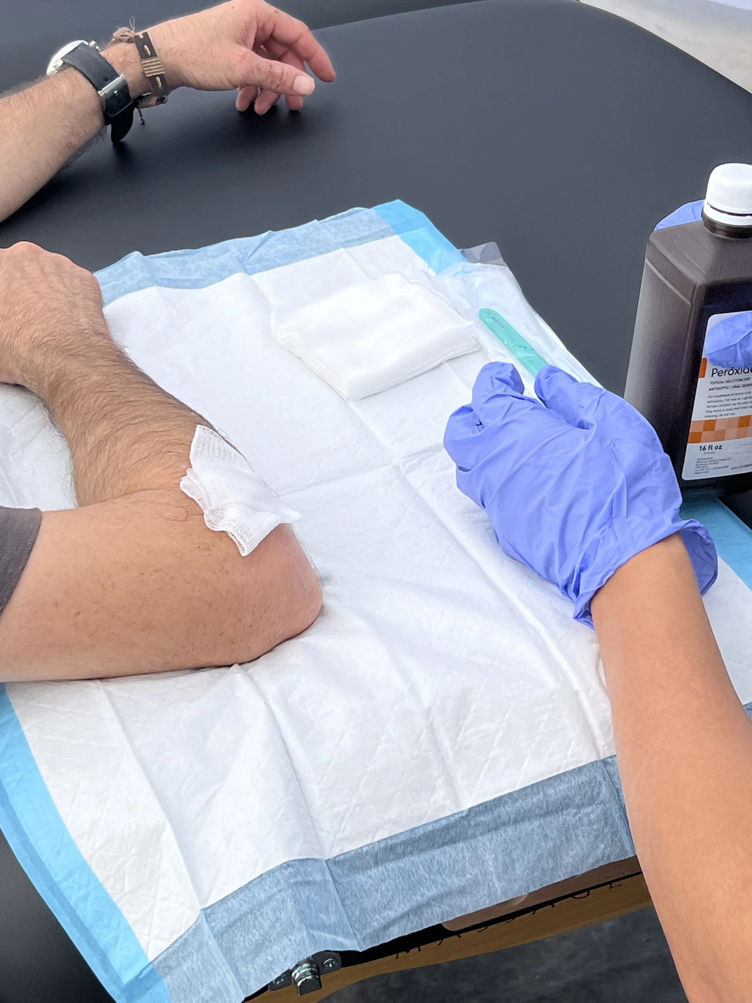 Person's arm on medical table with bandage, healthcare worker's gloved hand, peroxide bottle, gauze pad, syringe.